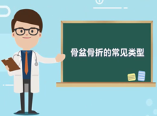 【醫(yī)療科普】骨盆骨折的常見(jiàn)類(lèi)型有哪幾種？