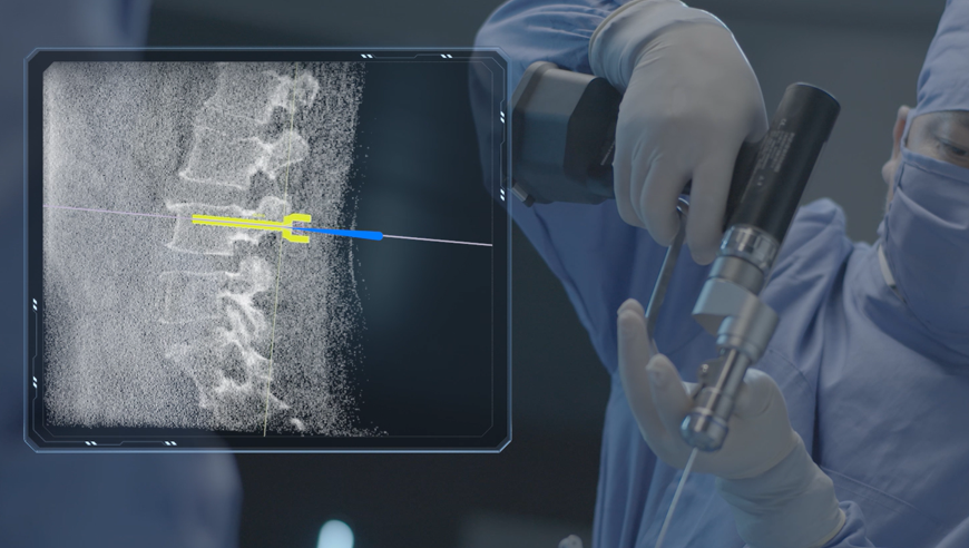 機(jī)器人做手術(shù)好還是醫(yī)生做手術(shù)好，機(jī)器人做手術(shù)有哪些好處？