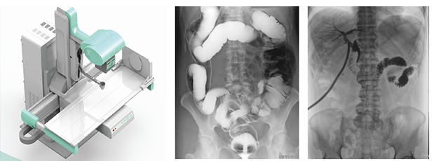 多功能動態(tài)dr 多功能動態(tài)dr