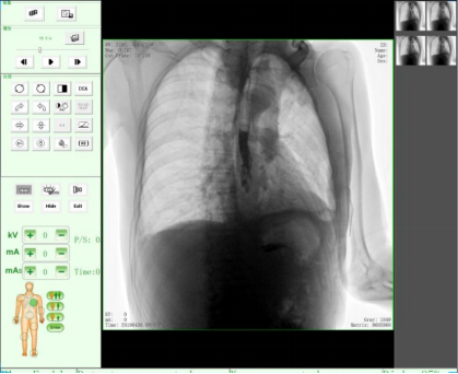X射線影像 X射線影像