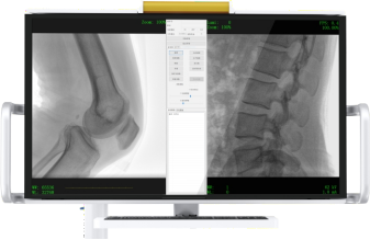 平板C形臂超寬屏顯 平板C形臂超寬屏顯