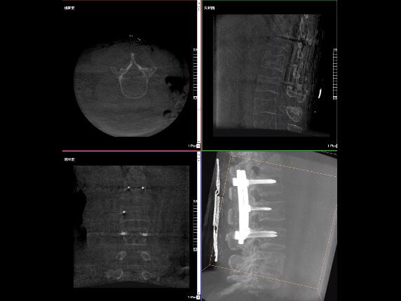 【醫(yī)療科普】2分鐘帶你了解高質(zhì)量X光片的標(biāo)準(zhǔn)是什么？