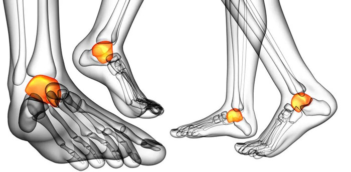 【醫(yī)療科普】三維影像可以清楚地看到關(guān)節(jié)面 【醫(yī)療科普】三維影像可以清楚地看到關(guān)節(jié)面