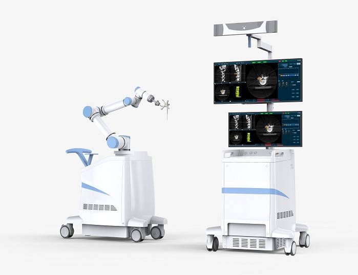骨科導(dǎo)航機器人 骨科導(dǎo)航機器人