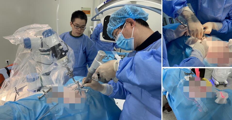 脊柱微創(chuàng)手術(shù)機器人-手術(shù)微創(chuàng)化 脊柱微創(chuàng)手術(shù)機器人-手術(shù)微創(chuàng)化