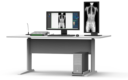 大視野平板動態(tài)DR全脊柱一次成像 大視野平板動態(tài)DR全脊柱一次成像