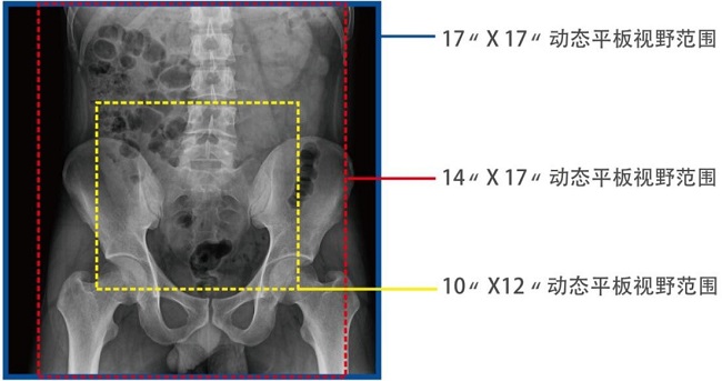 動態(tài)DRF的平板